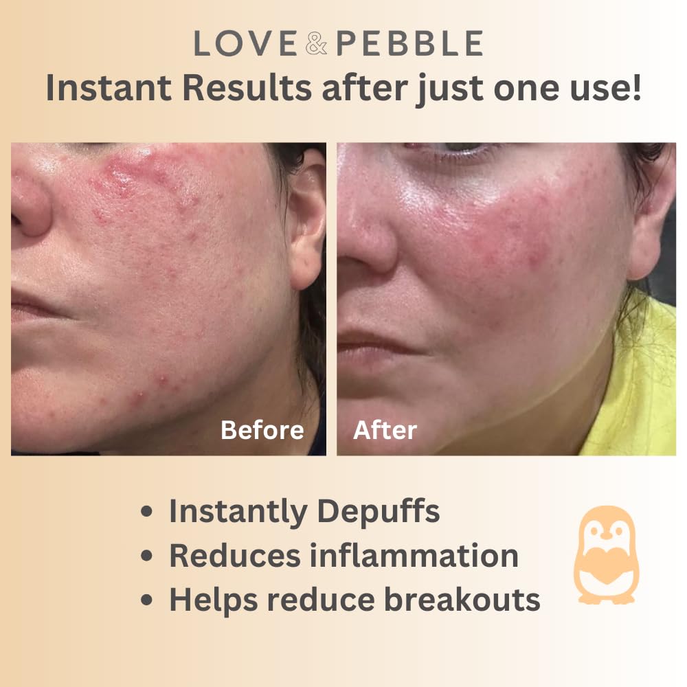 🧊 Love & Pebble Beauty Pops – Cryo Facial Mask for Instant Glow & Skin Vitality