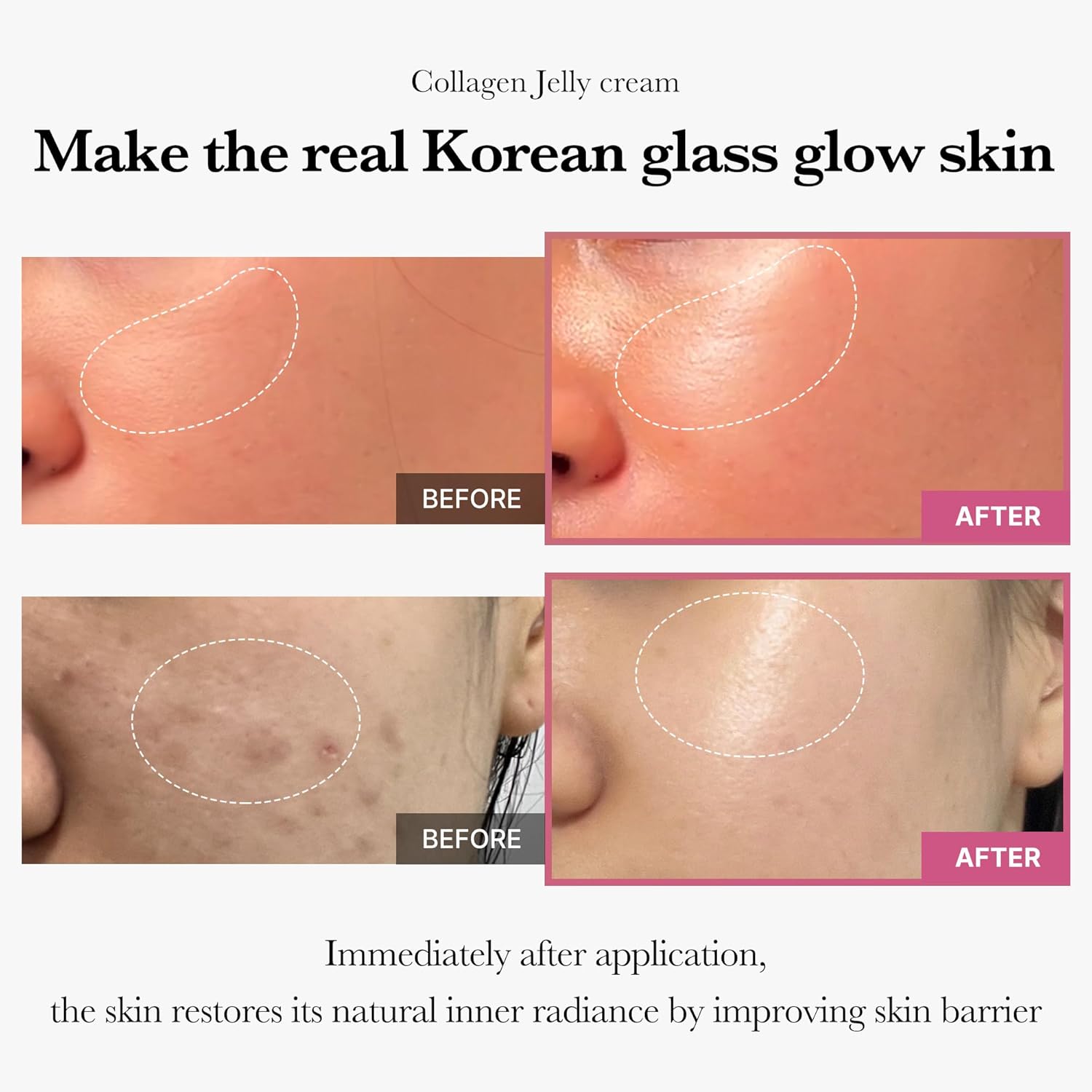 🌟 Korean Collagen Jelly Cream – 24H Hydration & Glow | Deep Barrier Repair & Anti-Aging Formula