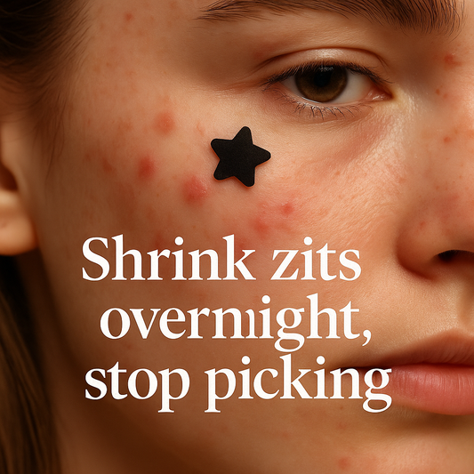 ⭐ SkinThrone™ Pimple Patches